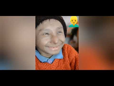 world smallest man|khagendra thapa magar| pokara|Nepal..