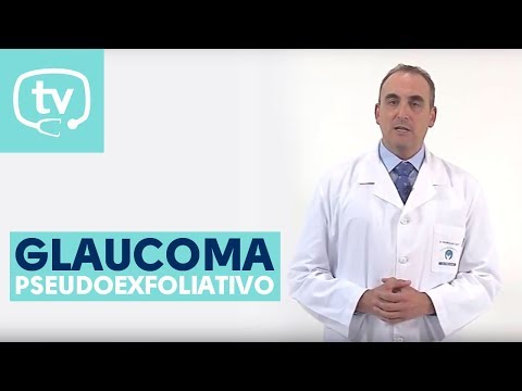 El glaucoma pseudoexfoliativo