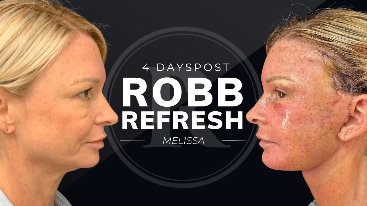 Robb Facial Plastic Surgery