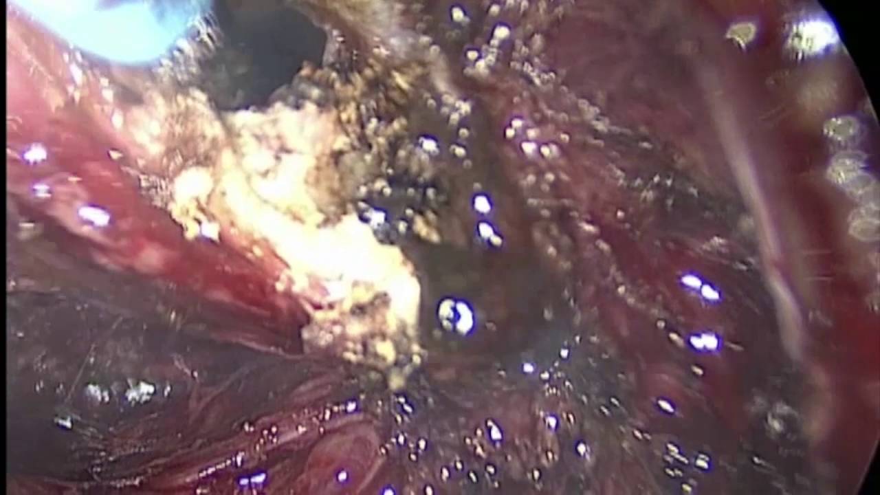 Henry Octavio Rodríguez Daza-13