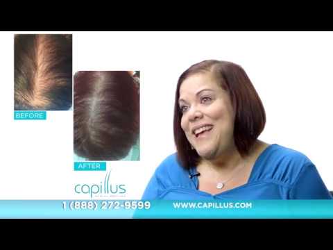 Capillus Laser Hair Therapy - Isabel
