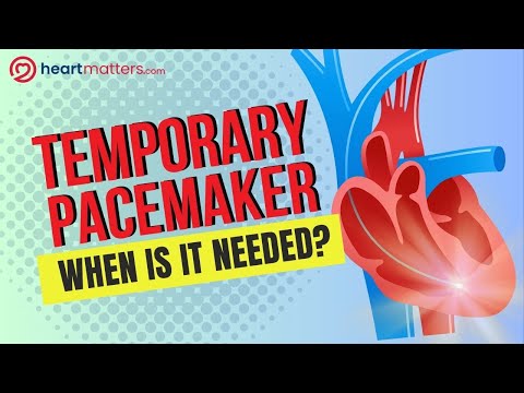 Temporary Pacemakers Explained: Life-Saving Support