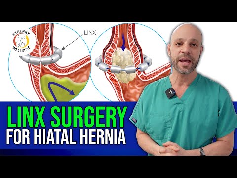 LINX surgery for Hiatal Hernia, Acid Reflux and Gerd