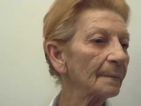 Argireline el lifting facial rapido