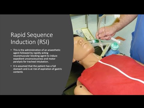 Rapid Sequence Induction (RSI)  -  The 7 Ps (Aimed at novice anaesthetist)