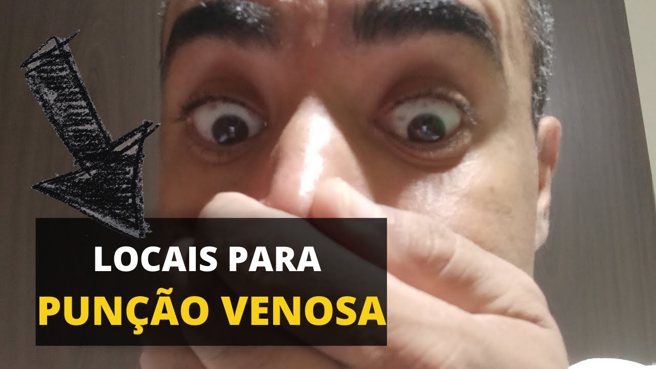 Punção venosa periférica -  veja o passo a passo e os locais para punção venosa