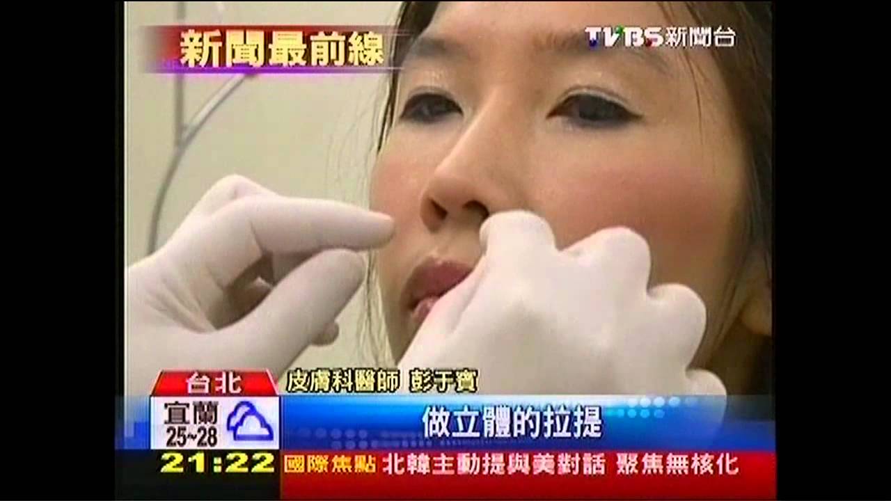 愛美微整型　超過3成想隆鼻