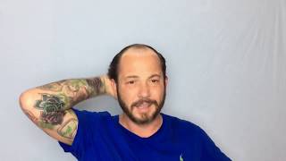 Feeling Awkward in public with your first Hair Replacement, Dont!!!