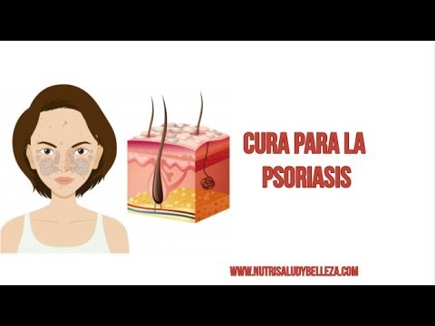Curare leczema dallinterno Cura di omeopatia di psoriasi