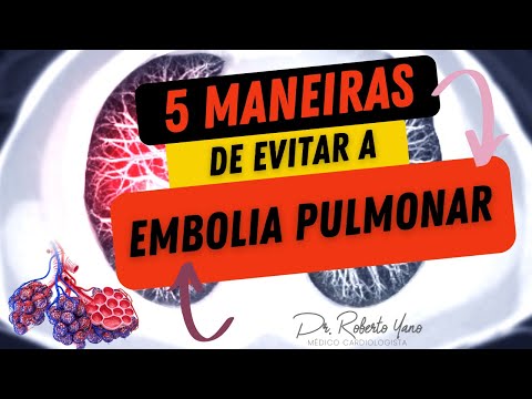 5 ways to avoid Pulmonary Embolism. Is pulmonary thromboembolism serious?