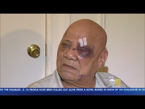 Bronx Man Beaten In His Lobby