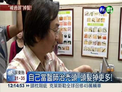 別自己當醫師! 狂吃中藥竟禿頭