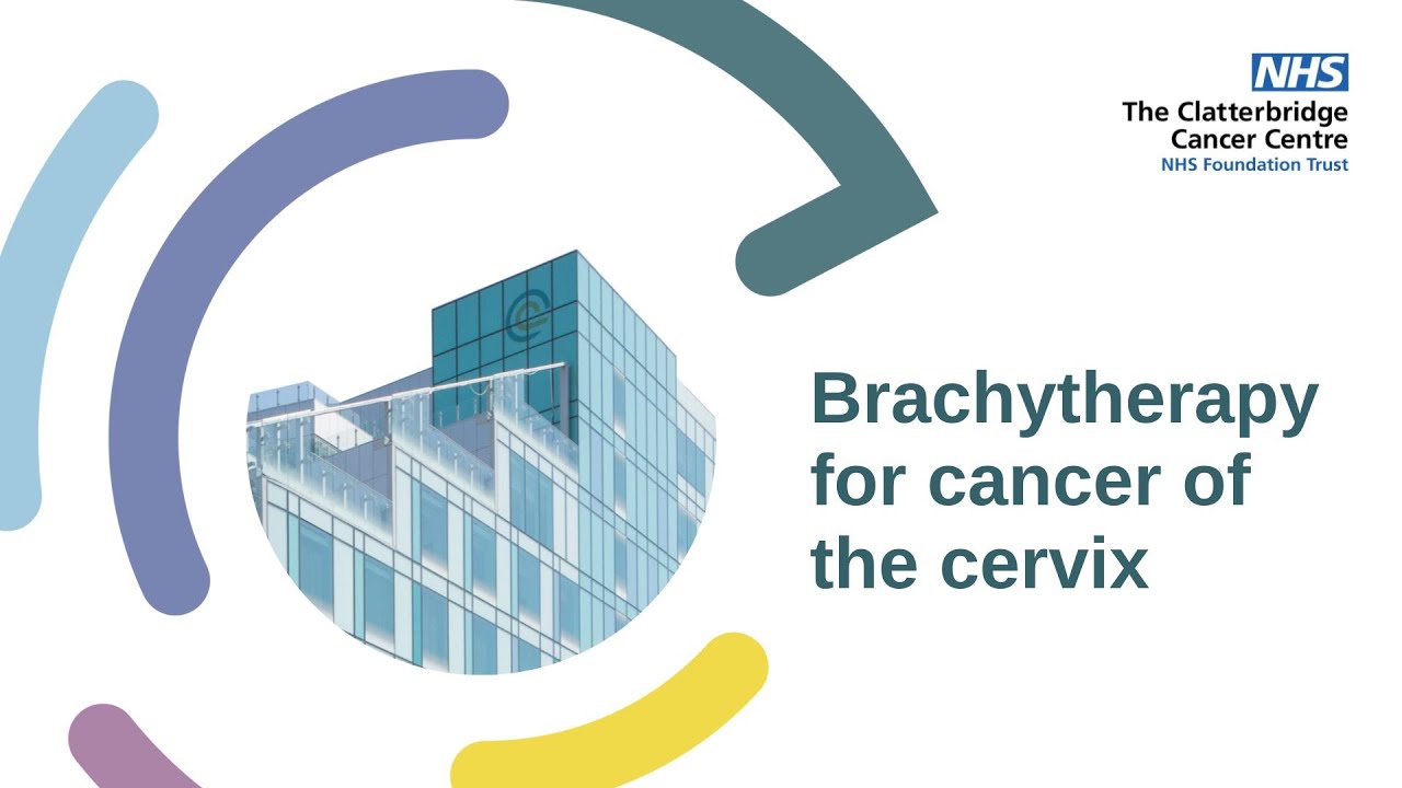 Brachytherapy for cancer of the cervix