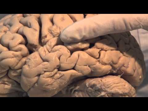 Introduction: Neuroanatomy Video Lab - Brain Dissections