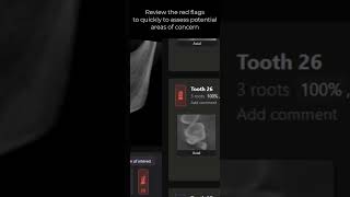 Adding AI to your ImageWorks Dental Conebeam enables one-click diagnosis #shorts