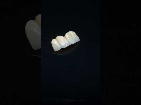 YouTube 썸네일