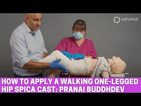 How to apply a walking one-legged hip spica cast —paediatrics trauma— educational video for surgeons