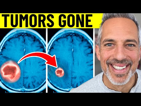 My Fasting Regimen for Cancer That Shrunk My Tumors Fast