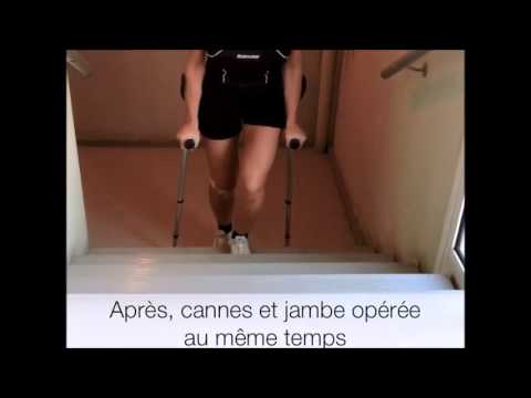 comment monter escalier avec bequilles