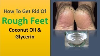 how to get rid of rough feet - Coconut Oil & Glycerin