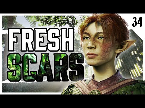 Fresh Scars | Legacy of the Ashen E34 | DND Actual Play
