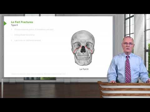 Le Fort Fractures – Head & Neck Anatomy