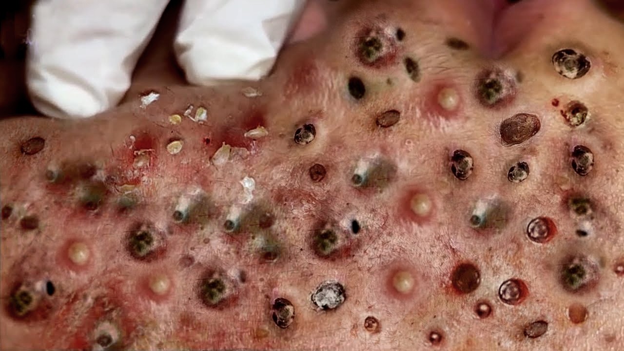 𝑨𝒄𝒉𝒊𝒆𝒗𝒆 𝑰𝒏𝒏𝒆𝒓 𝑷𝒆𝒂𝒄𝒆 𝑾𝒊𝒕𝒉 𝑻𝒉𝒆𝒔𝒆 𝑭𝒂𝒄𝒊𝒂𝒍 𝑪𝒍𝒆𝒂𝒏𝒔𝒊𝒏𝒈 𝑴𝒆𝒕𝒉𝒐𝒅𝒔 #9008385