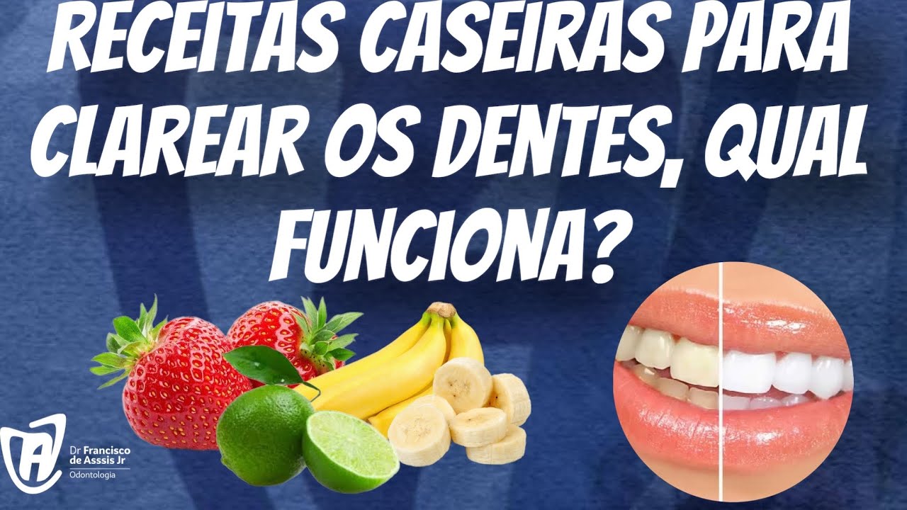 Francisco De Assis Almeida Lima Júnior-86