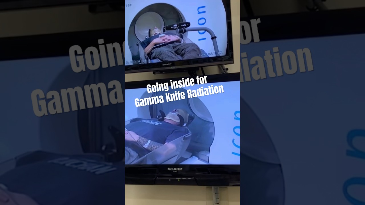 Gamma Knife Radiation machine for brain cancer #shorts