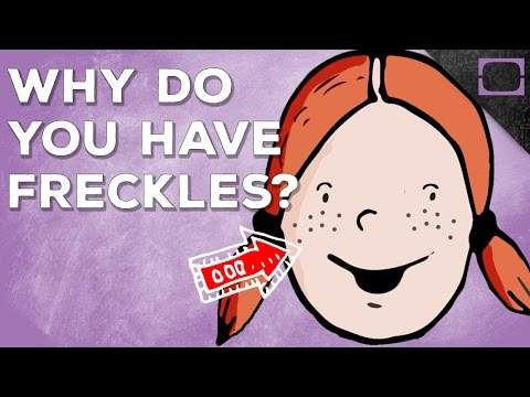 Why Do You Have Freckles?