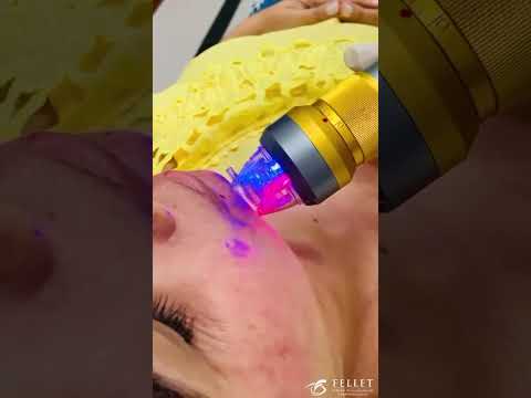Liziane Fellet-10