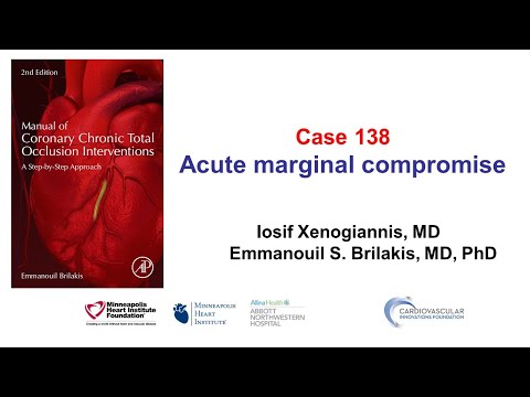 Case 138: Manual of CTO PCI - Importance of acute marginals