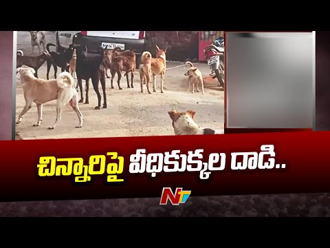 Stray Dogs Attack 5 Years Child In Kompally, Hyderabad | Ntv