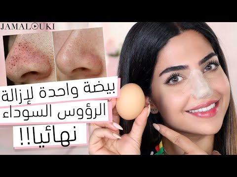 الرؤوس السوداء: ازالة الرؤوس السوداء بأبسط طريقة في المنزل هنا hana