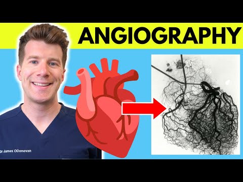 Arzt erklärt Angiographie (Angiogramm) | Anwendung, Durchführung, Risiken und mehr