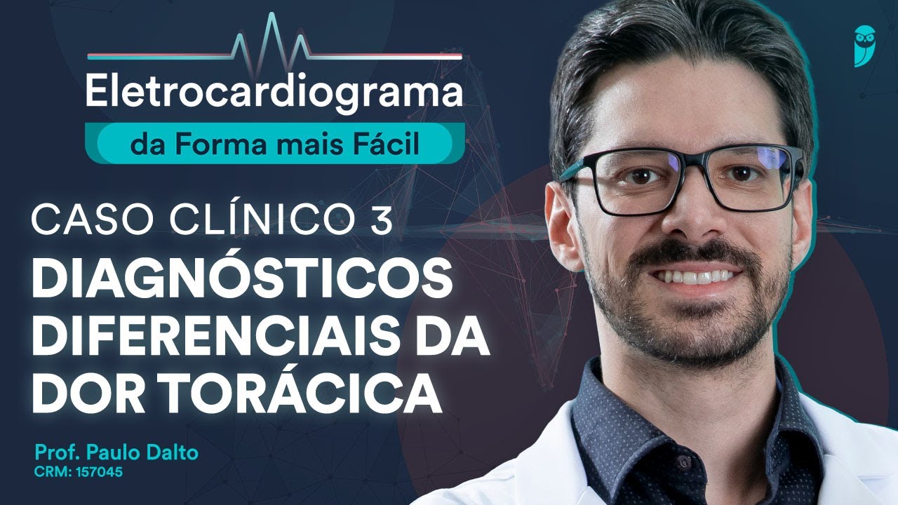 Caso Clínico 3 (Diagnósticos Diferenciais da Dor Torácica) - Eletrocardiograma da Forma mais Fácil
