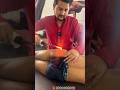Sciatica Buttock Pain Agni Karma In Ayurveda Dr Amit Bharti Dehradun