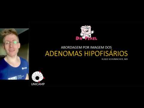 ADENOMAS HIPOFISÁRIOS | Abordagem radiológica inicial