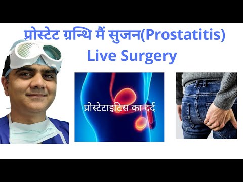 Prostatitis kezelési kezelési módszerek