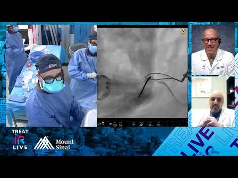 Transjugular Intrahepatic Portosystemic Shunt (TIPS) using " ...