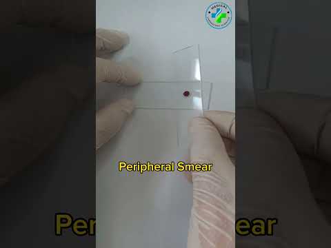 Making a peripheral blood smear | blood smear preparation | prepare a perfect blood smear|Hematology