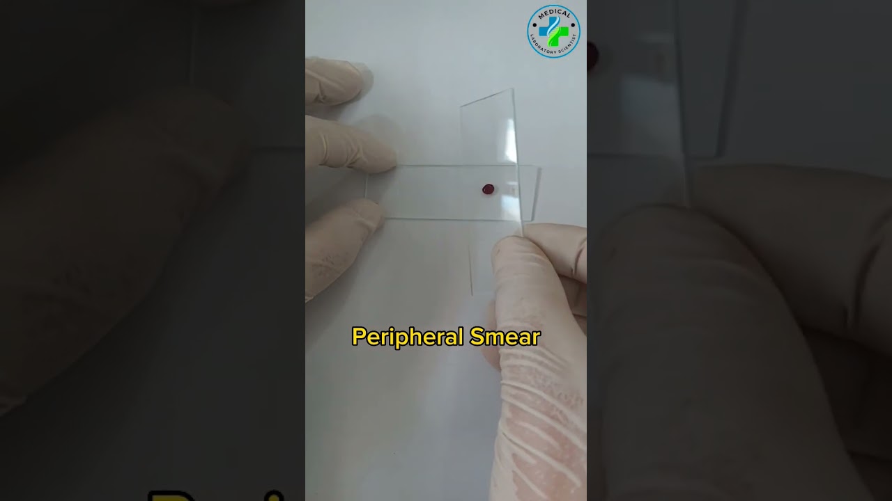 Making a peripheral blood smear | blood smear preparation | prepare a perfect blood smear|Hematology