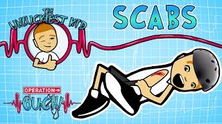 Science for kids - Scabs | Operation Ouch | Experiments for kids