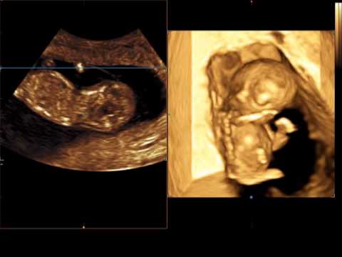 Se è possibile cliccare nocche Che ha fatto dellanca in Germania