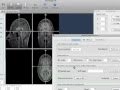 Autoscale Of Vmr Files Brainvoyager QX Using Applescript