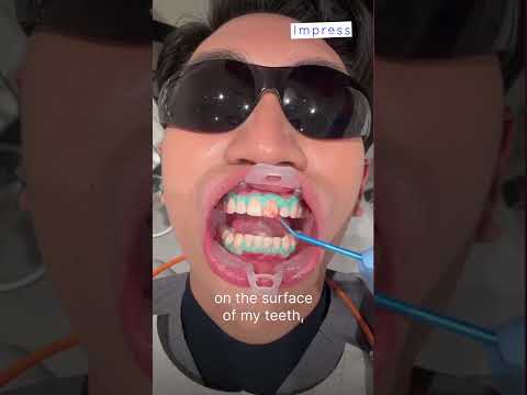 Come with me to get my teeth whitened at Impress!