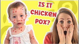 What's Wrong With Angie? | Hand Foot and Mouth Or Chicken Pox?