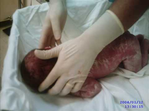 Nosso primeiro bebê