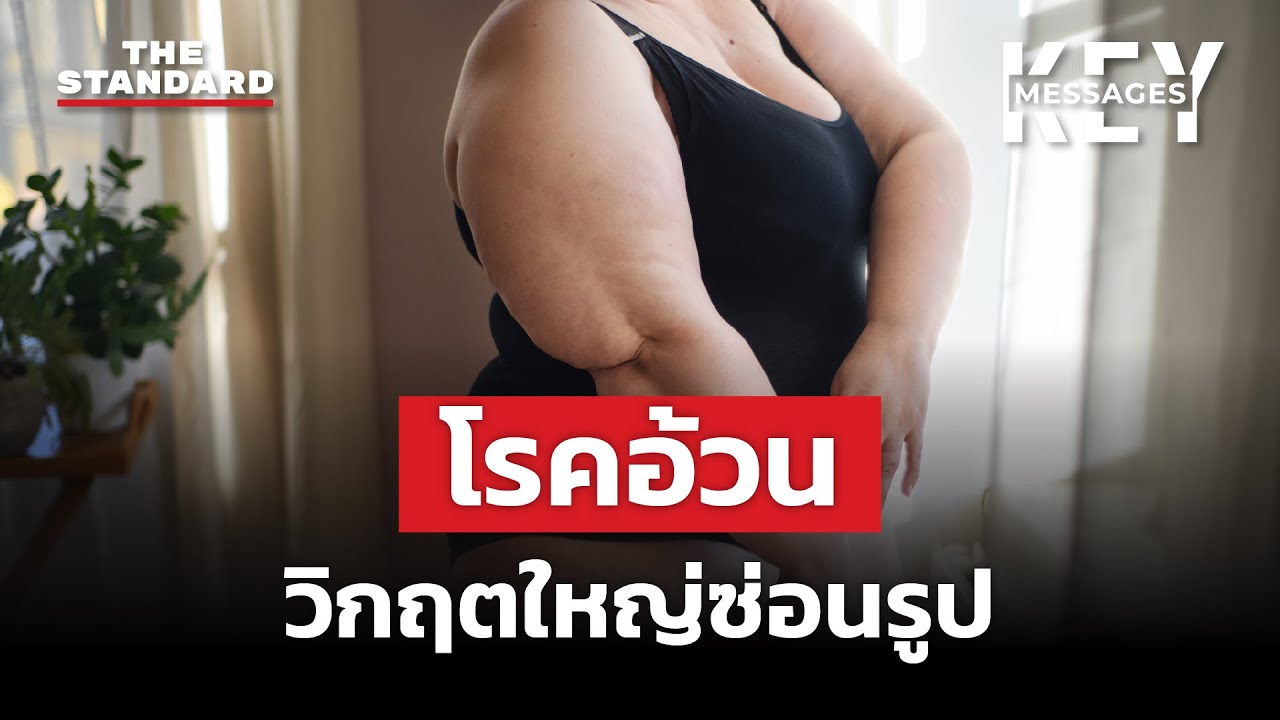 วิกฤตโรคอ้วน ภัยคุกคามต่อสุขภาพคนทั่วโลก | KEY MESSAGES #164