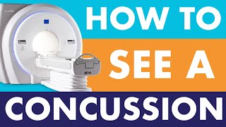 How to detect a concussion with an fMRI | Cognitive FX